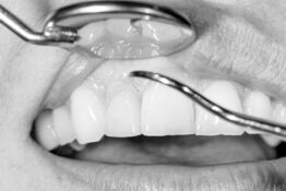 Periodontitis therapy in practice for oral, maxillofacial and facial surgery