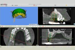 Modern technology in practice for oral, maxillofacial and facial surgery
